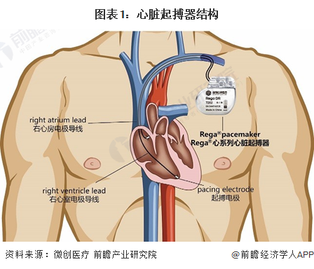 预见2024：2024年中国心脏起搏器行业市场规模、竞争格局及发展前景预测 未来市场规模将超80亿元金年会金字招牌(图1)